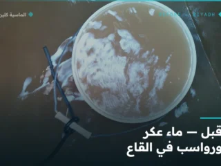 تعقيم الخزانات بالرياض — الياسمين — قبل الخدمة